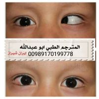 علاج أمراض العيون فی شیراز
